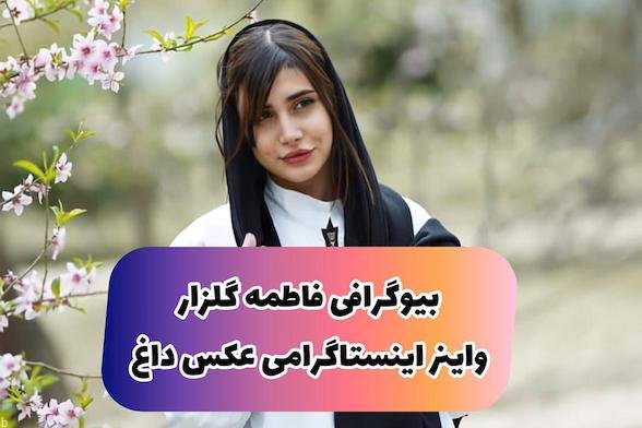 فاطمه گلزار کیست؟ | تیک تاکر دختر ایرانی با حواشی بیشتر بشناسید!!